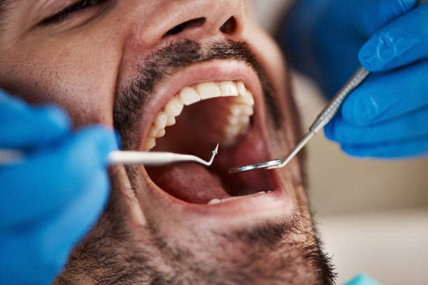 Best Emergency Dental Care for Trauma or Injury in Alpharetta, GA