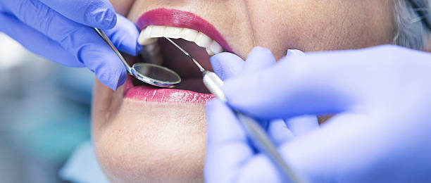 Best Emergency Tooth Extraction in Alpharetta, GA